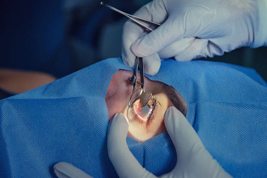 Cataract Surgery